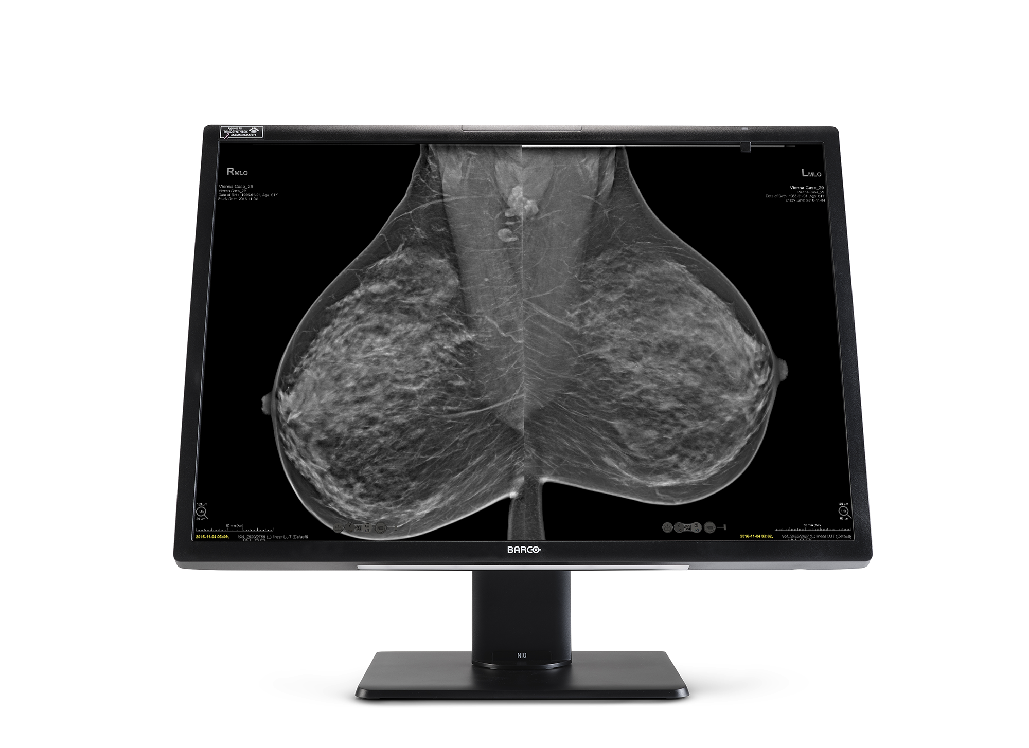 Breast Imaging Diagnostic Display