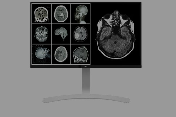 LG Clinical Review Monitors