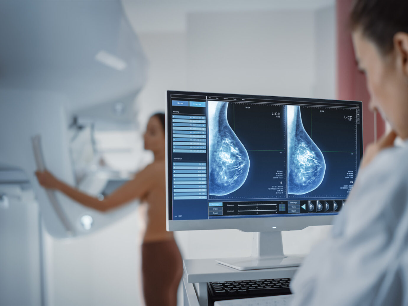 Mammogram
