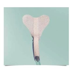 StatLock Nasogastric Adult with Skin Prep - Pack of 200