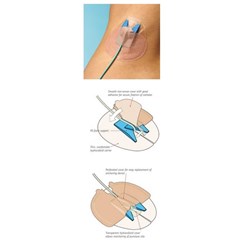 Medlab Drain Guard - Single