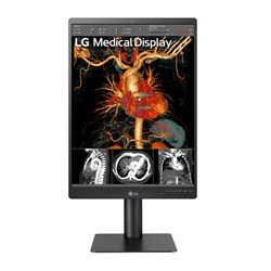 LG MODEL 21HQ513D 21" 3MP DIAGNOSTIC MONITOR