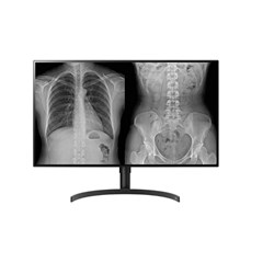 LG 32 WARRANTY UPGRADE YEARS 4 AND 5 FOR 32HL512D