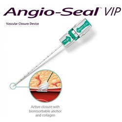 Angio-Seal VIP Closure Device  - 6F - 0.035" Wire - Pack of 0